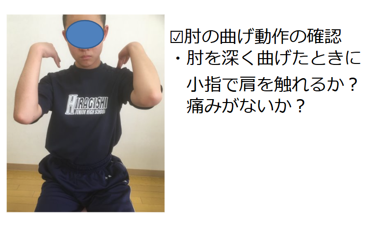 ①肘の曲げ動作のチェック 図は右の肘に制限がみられる