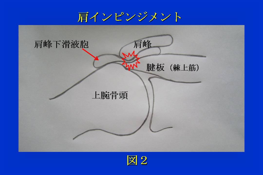 スライド2
