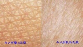 キレイな肌は好きですか？ 