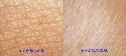 キレイな肌は好きですか？ 